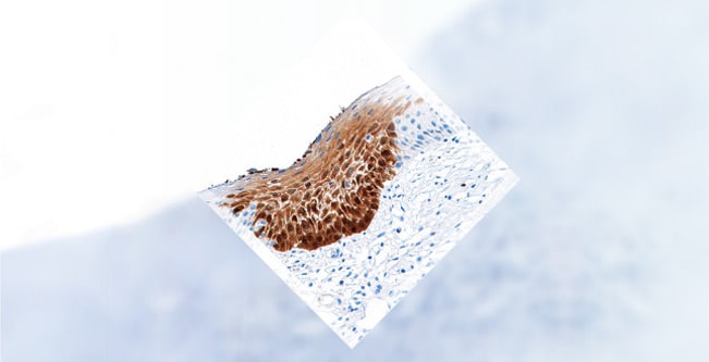 diagnose-cintec-carousel